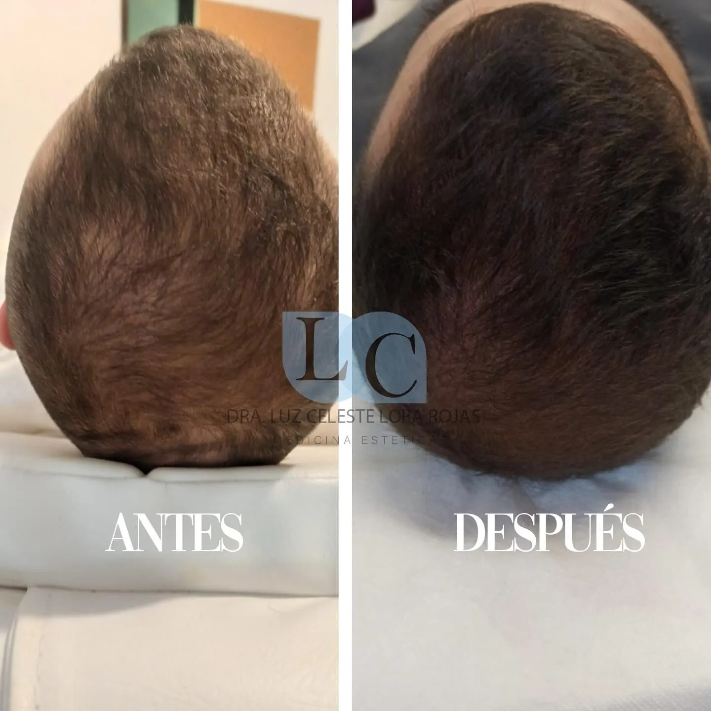 Por-qué-somos-los-mejores?